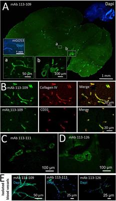 Brain blood vessel autoantibodies in patients with NMDA and GABAA receptor encephalitis: identification of unconventional Myosin-X as target antigen